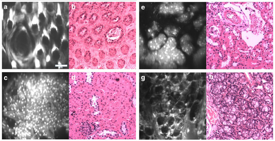 imagenes-microscopio-de-mano